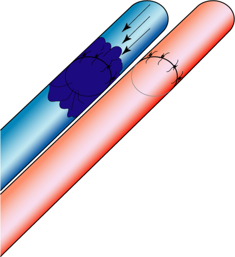 complications flaps fig3c