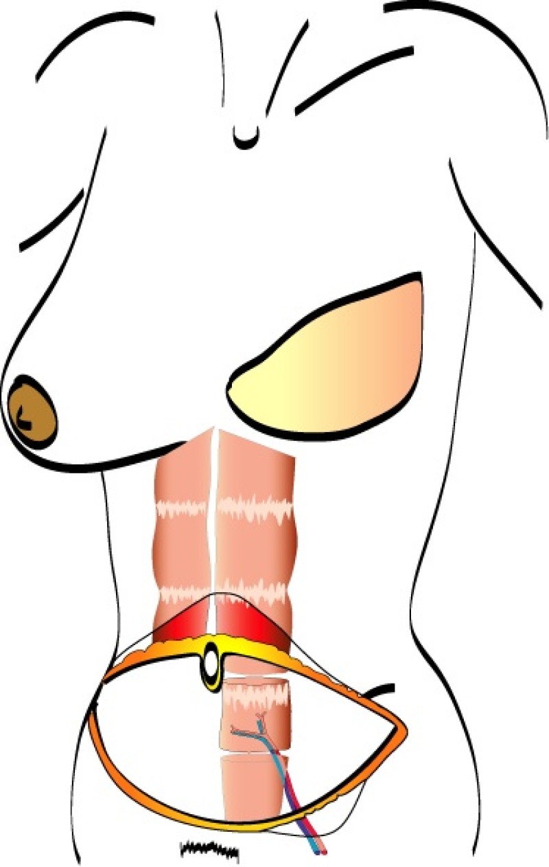freeTRAM techniek copy 2