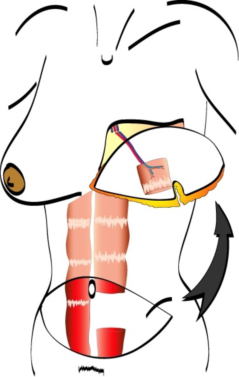 freeTRAM transfer copy 2