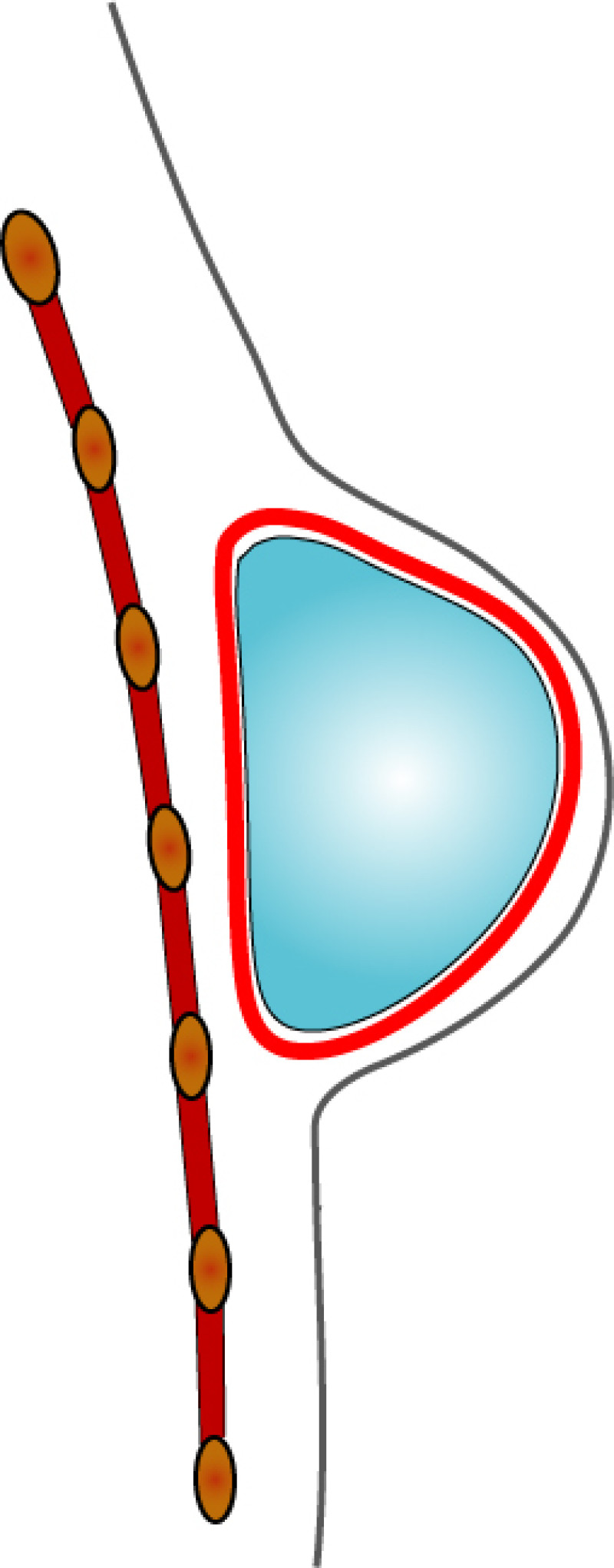 complications implants fig5